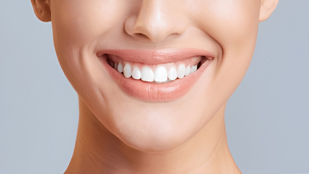 Dental Crowns Fort Saskatchewan