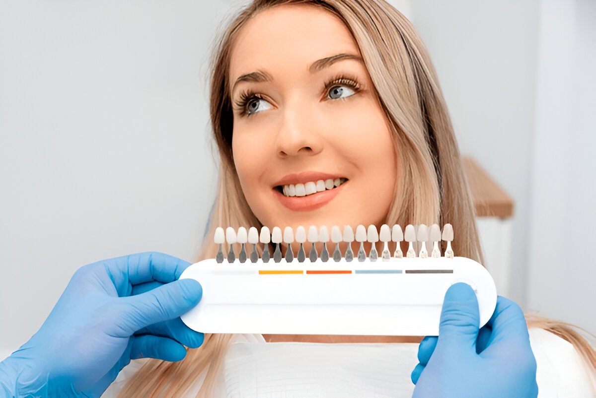 Veneers Fort Saskatchewan