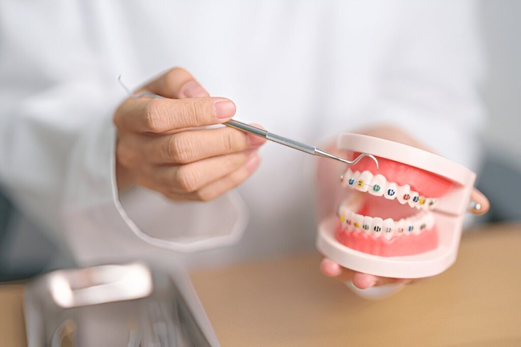 Adult Orthodontics Fort Saskatchewan | Ross Creek