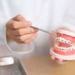 Adult Orthodontics Fort Saskatchewan | Ross Creek